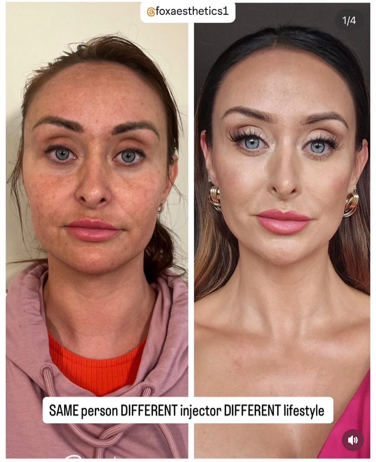 Skin consultation at FOX Aesthetics