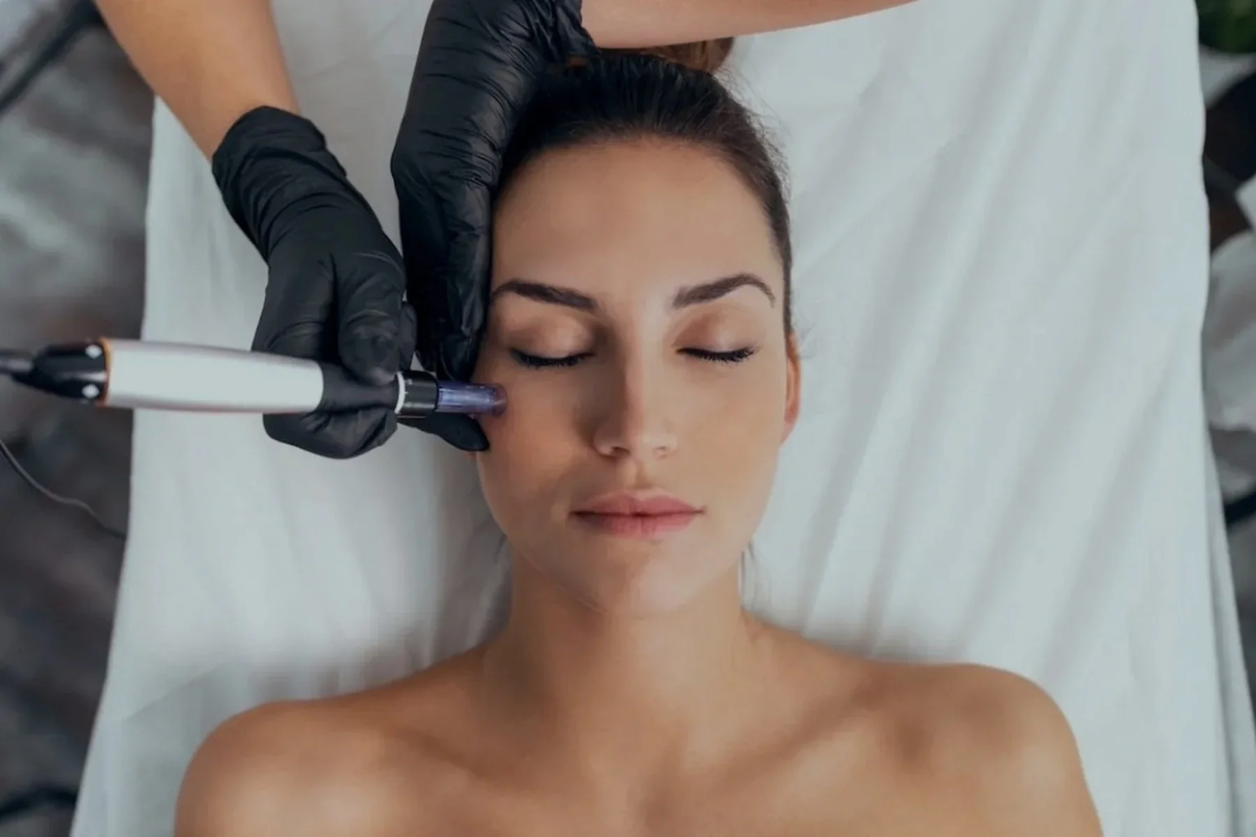 Advanced aesthetic treatment at FOX Aesthetics