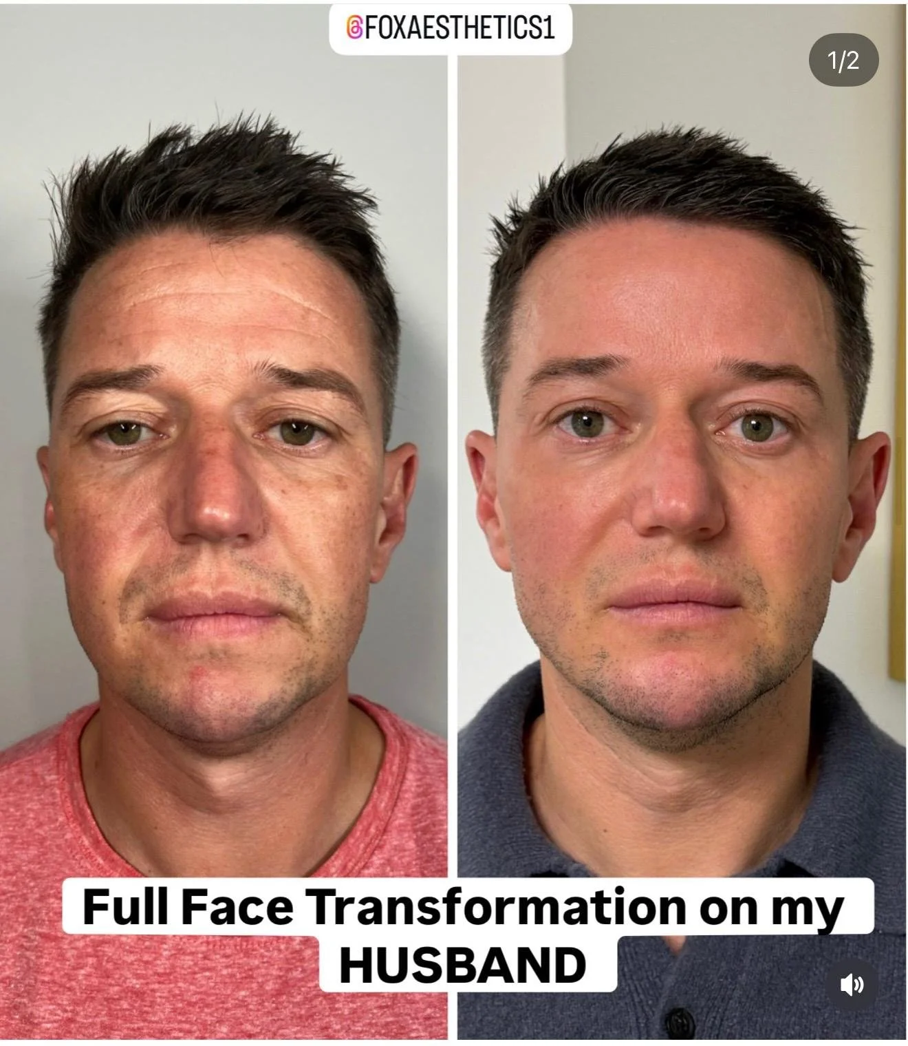 Professional skincare consultation