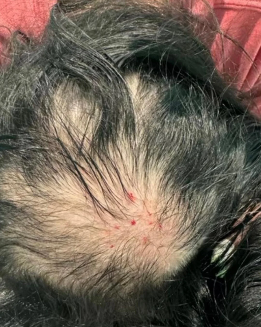 before and after.jpg