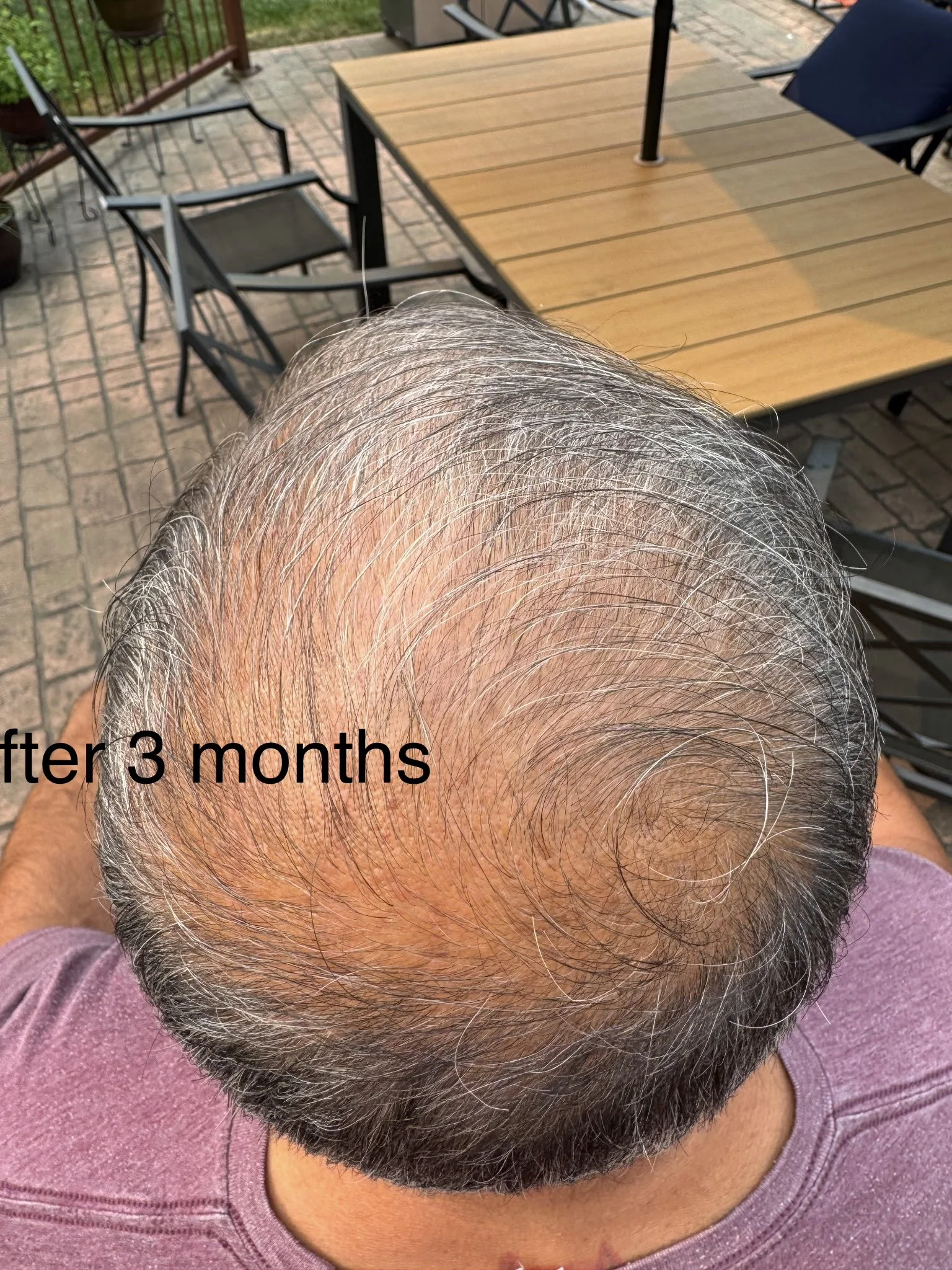 1000109606.jpeg