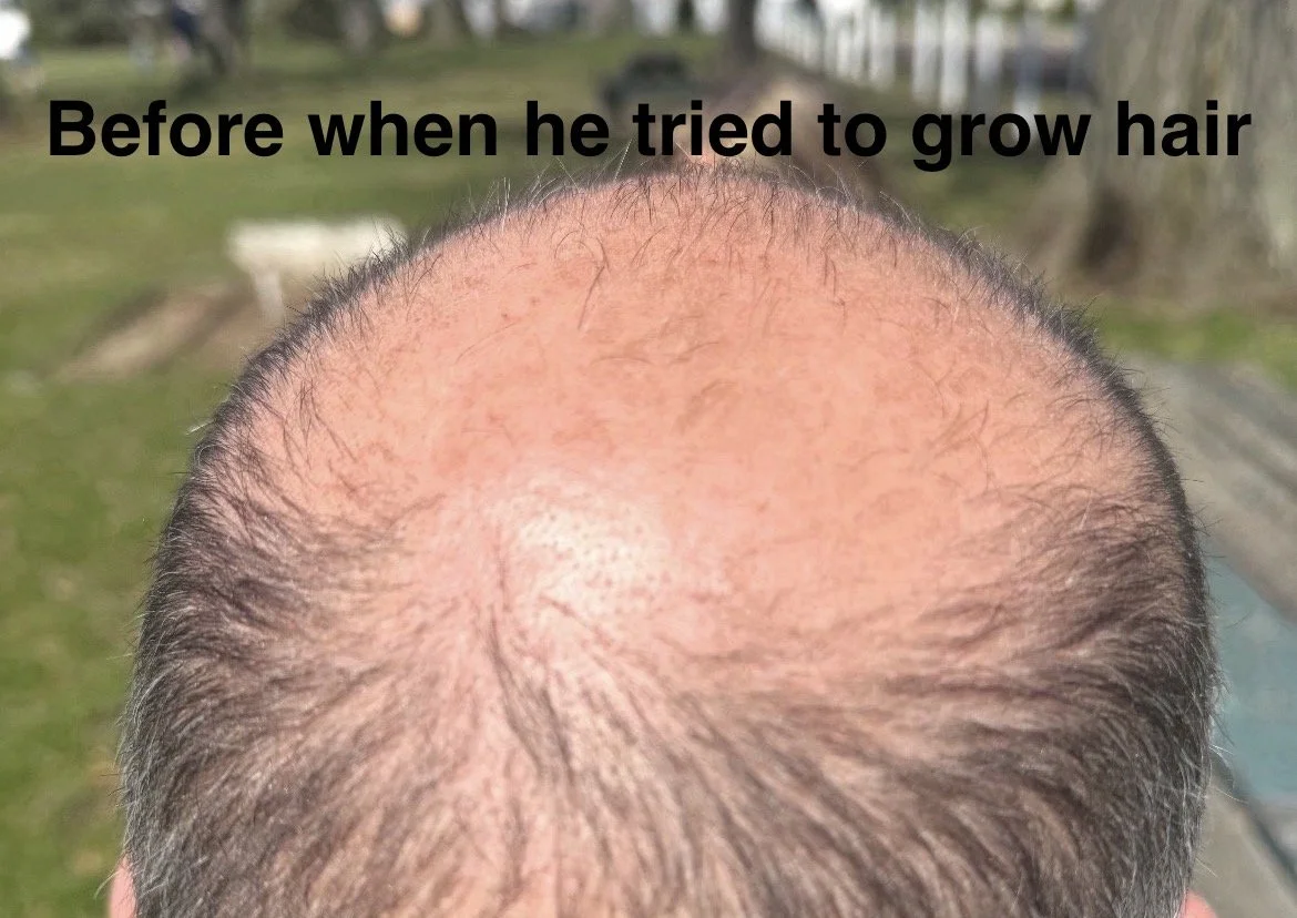 Jay posterior.jpg