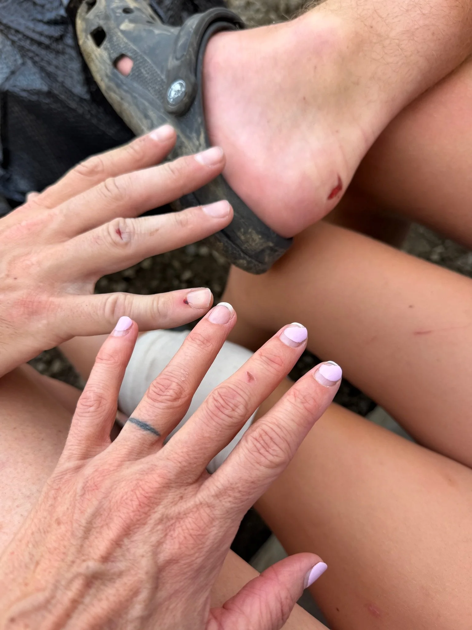Working hands and feet, (seems the first aid kit is pulled out multiple times a day)
