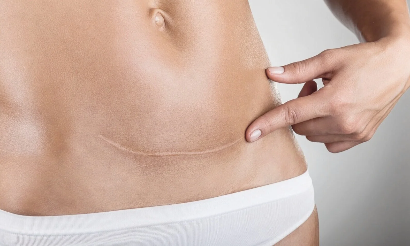 C-section related pain