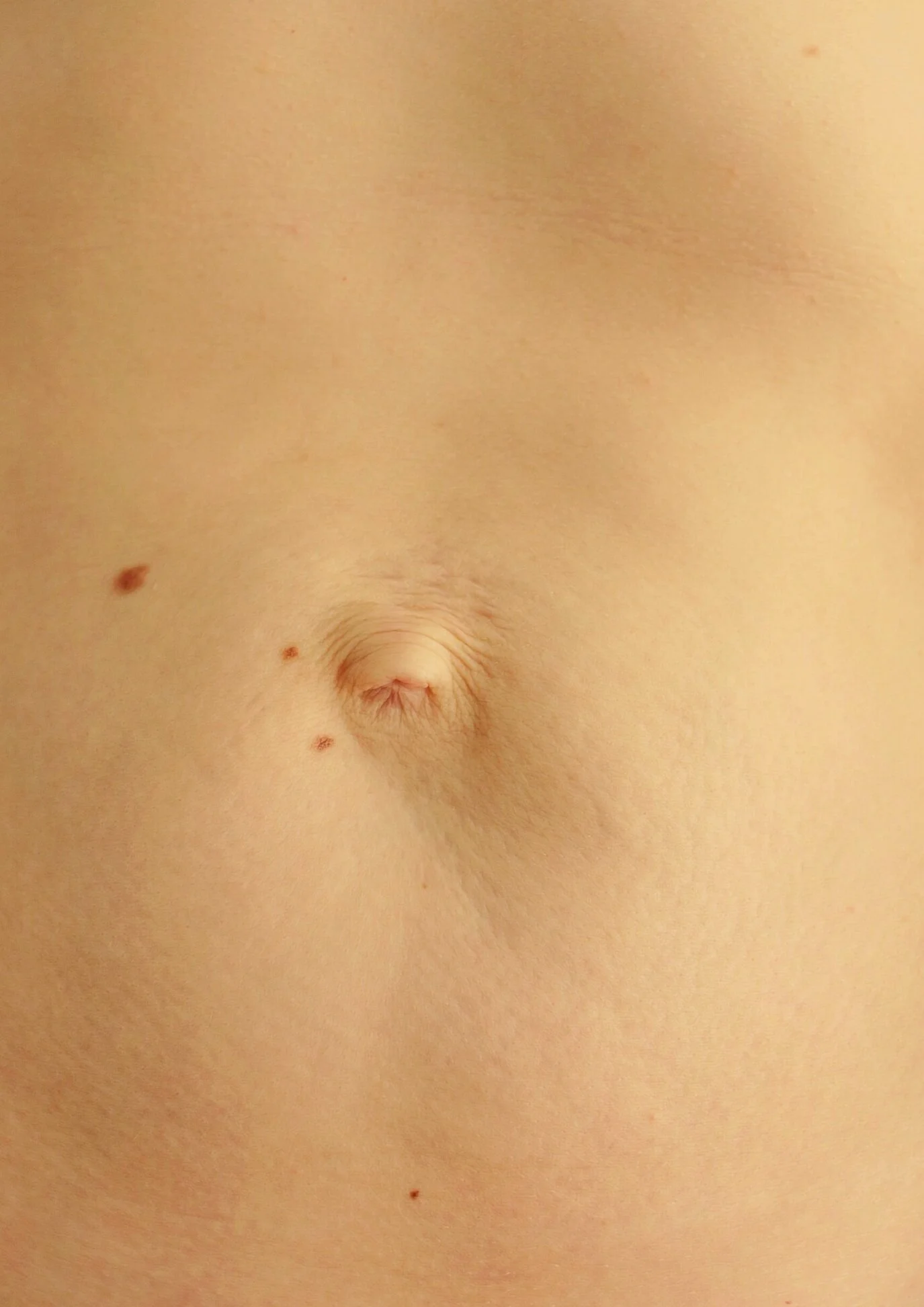 Diastase