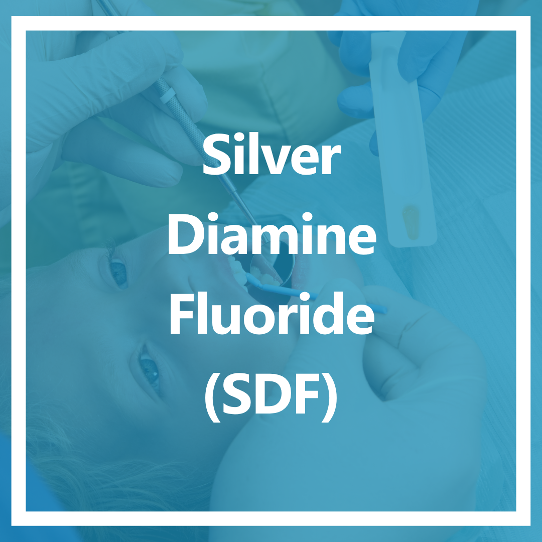 Silver Diamine Fluoride (SDF)