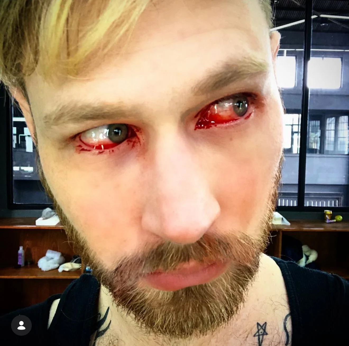 A close-up of a man with a beard and mustache, showing his face with red, bloodshot eyes and visible blood beneath his eyelids in a room with large windows and a dark interior.