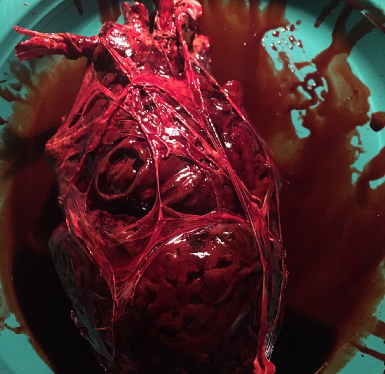 A human heart with visible blood vessels resting in a dark liquid inside a container.