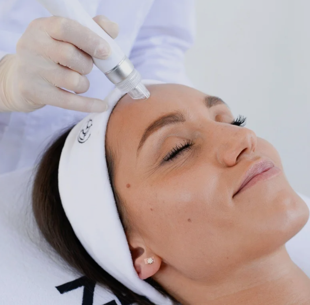 vitalis-aquaglow-deluxe-hydrodermabrasion-facial.png