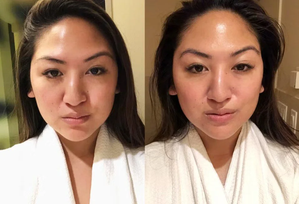 Event-Ready in 24–72 Hours: Safe Last-Minute Treatments Before Photos, Parties, or Interviews