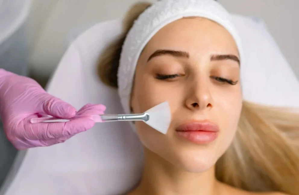 VITALIS Chemical Peel