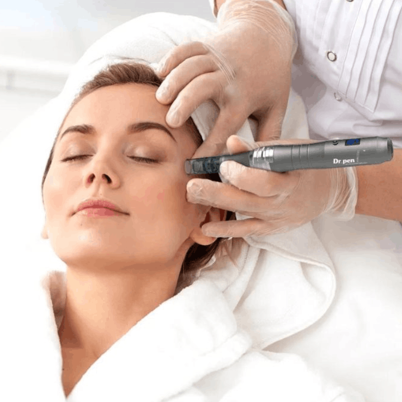 VITALIS MicroNeedling – Collagen Renewal Treatment