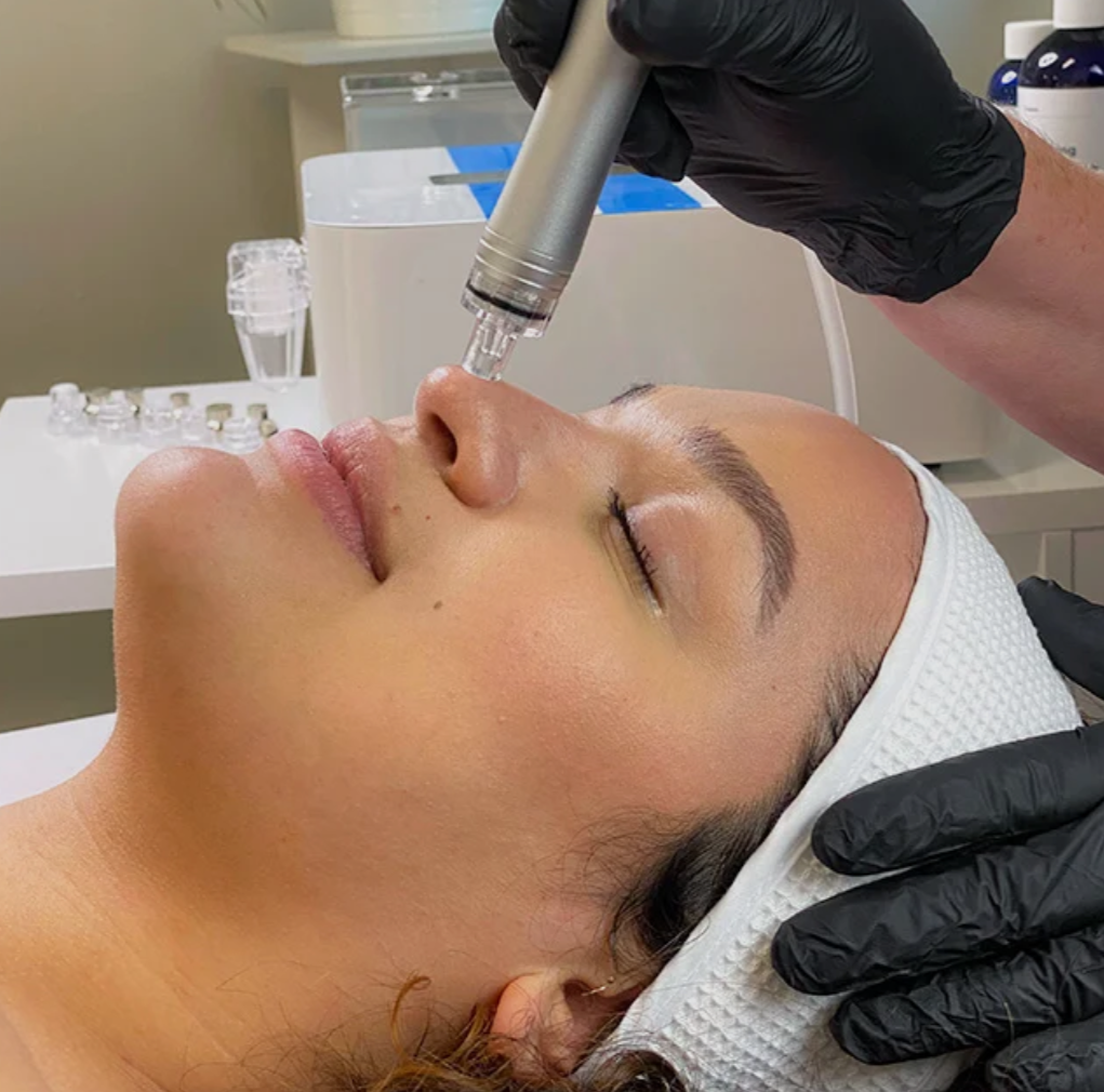 VITALIS AquaGlow Hydradermabrasion Facial