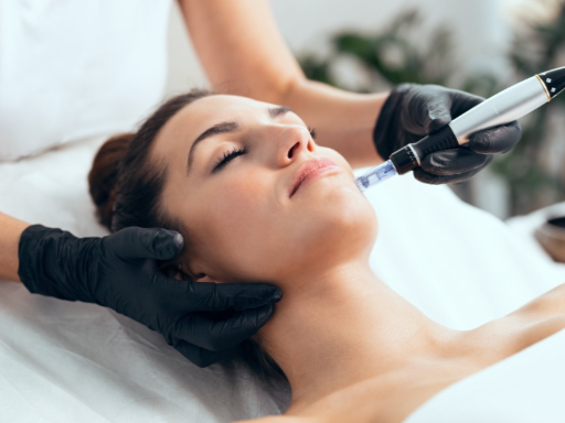 vitalis-microneedling-with-collagen.webp