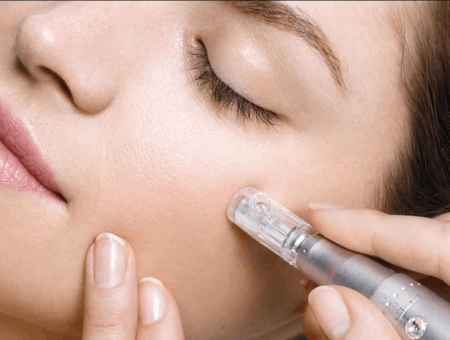 A woman receiving a professional microneedling treatment with exosomes, peptides, or growth factors to boost collagen production, accelerate skin rejuvenation, and maximize anti-aging results for smoother, brighter, more youthful-looking skin