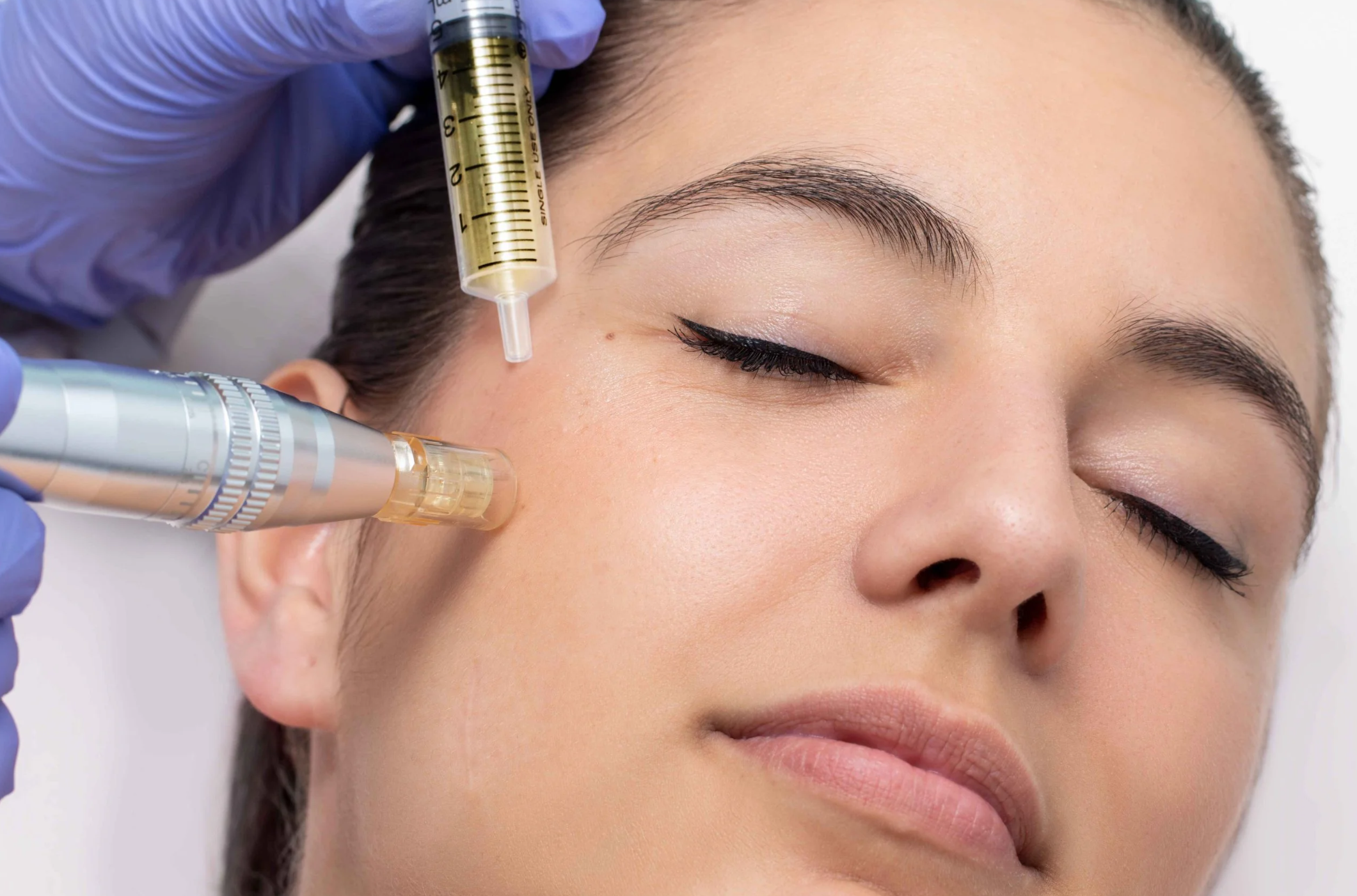 nanoneedling-advanced-infusion-medford-ma.png
