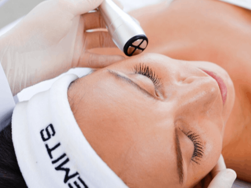 VITALIS RF Skin Tightening Facial