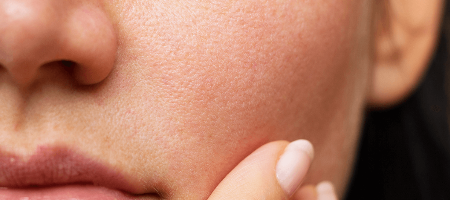Close-up of a woman's face, focusing on her nose, cheek, and lips with a finger touching her cheek.