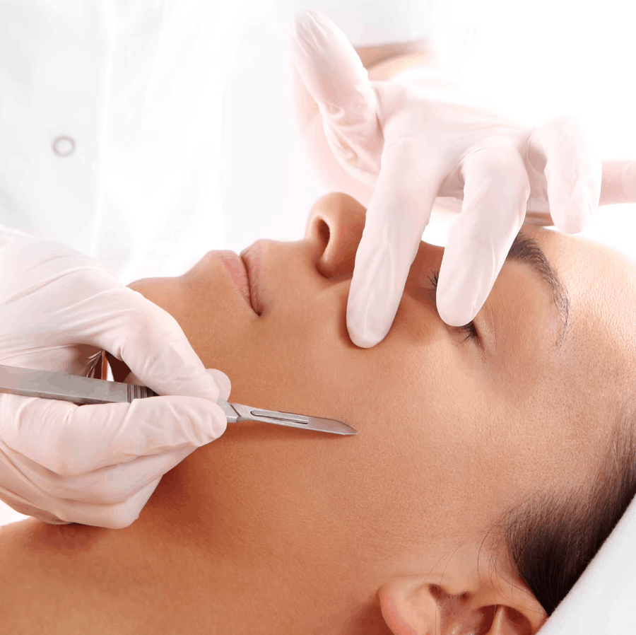 A woman receiving a professional dermaplaning treatment as a skincare specialist gently exfoliates the skin with a precision blade to remove peach fuzz and dead skin cells, revealing a smoother texture, brighter tone, and enhanced product absorption