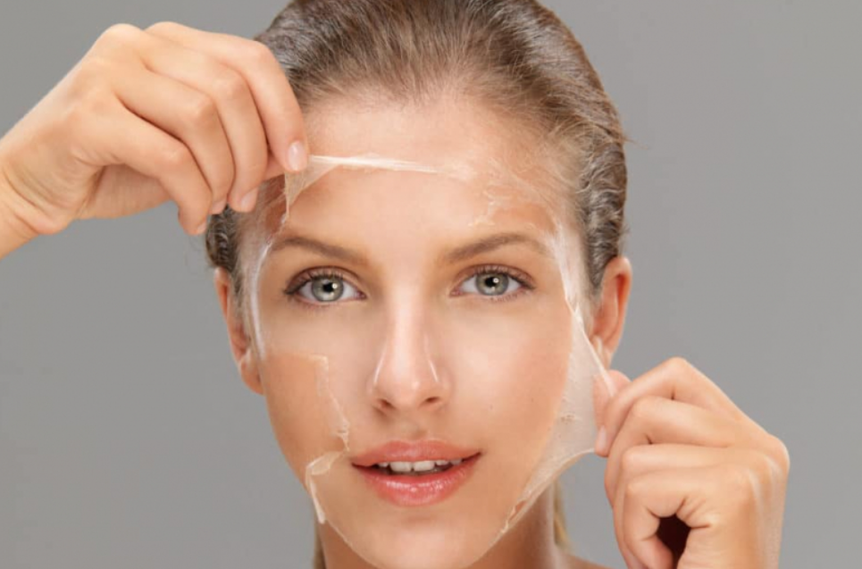 chemical-peel-package-medford-ma.png