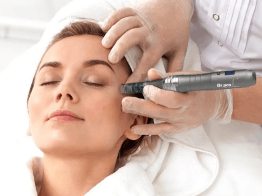 vitalis-microneedling-with-hyaluronic-acid.webp