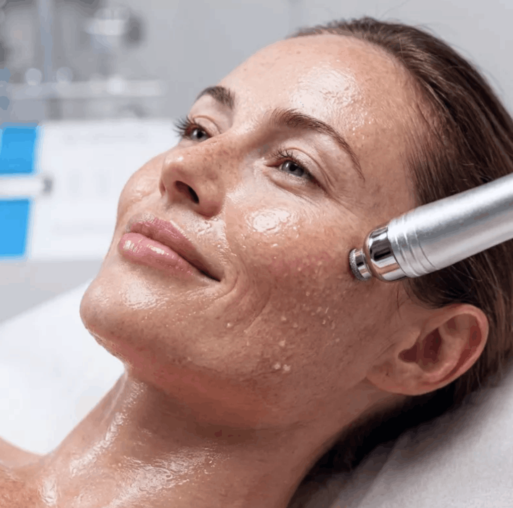 A woman receiving professional microdermabrasion as a skincare specialist gently resurfaces her skin to remove dead cells, smooth texture, soften fine lines and acne scars, and reveal a brighter, more even, youthful-looking complexion