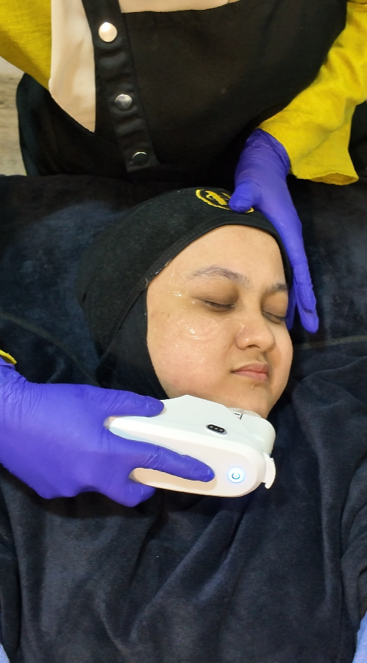 Rawatan HIFU facial di Hannan Medispa Utara untuk lifting wajah, menegangkan kulit kendur dan mengurangkan kedutan secara non-invasive