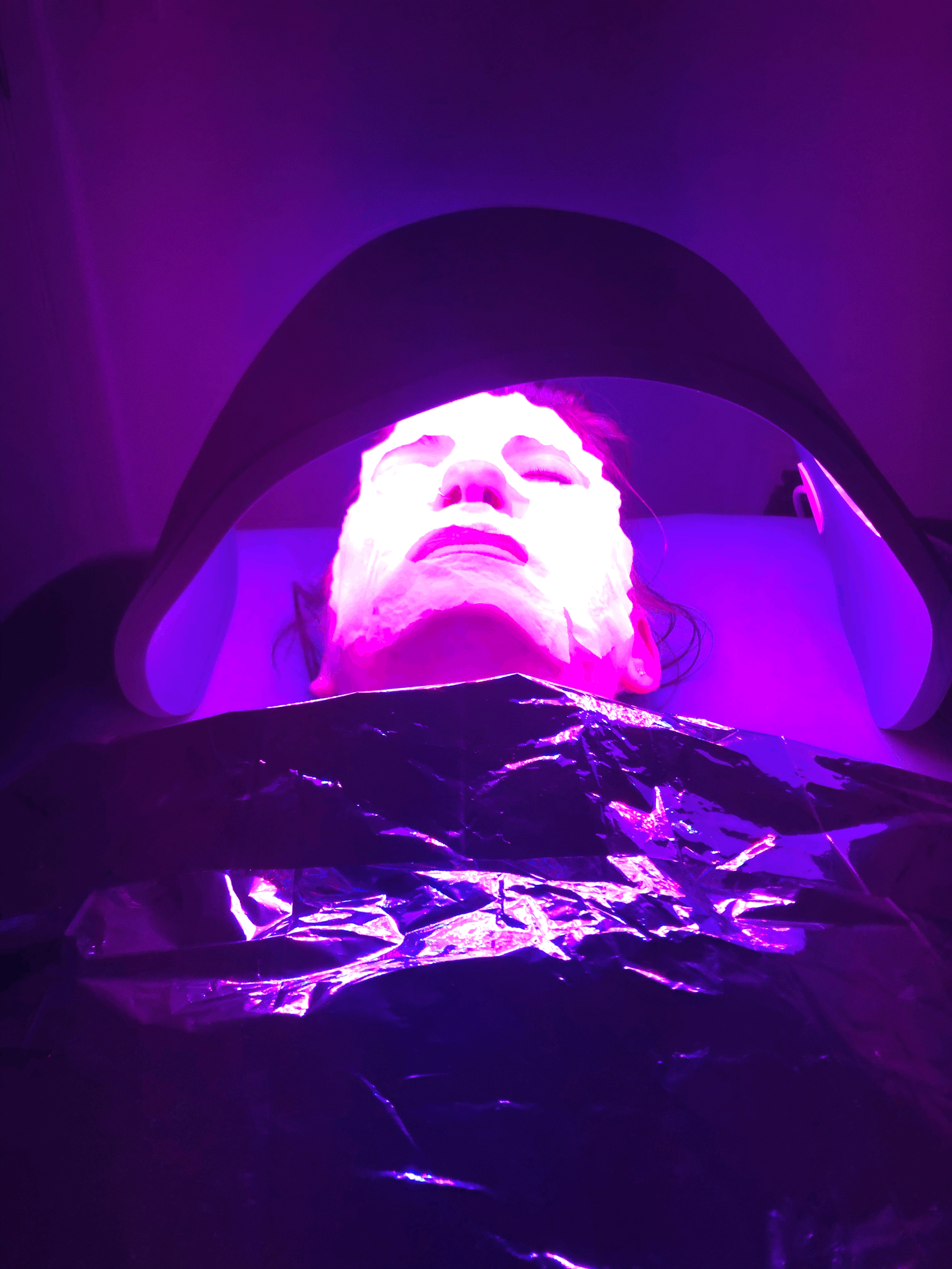 Facial Rejuvenation Acupuncture