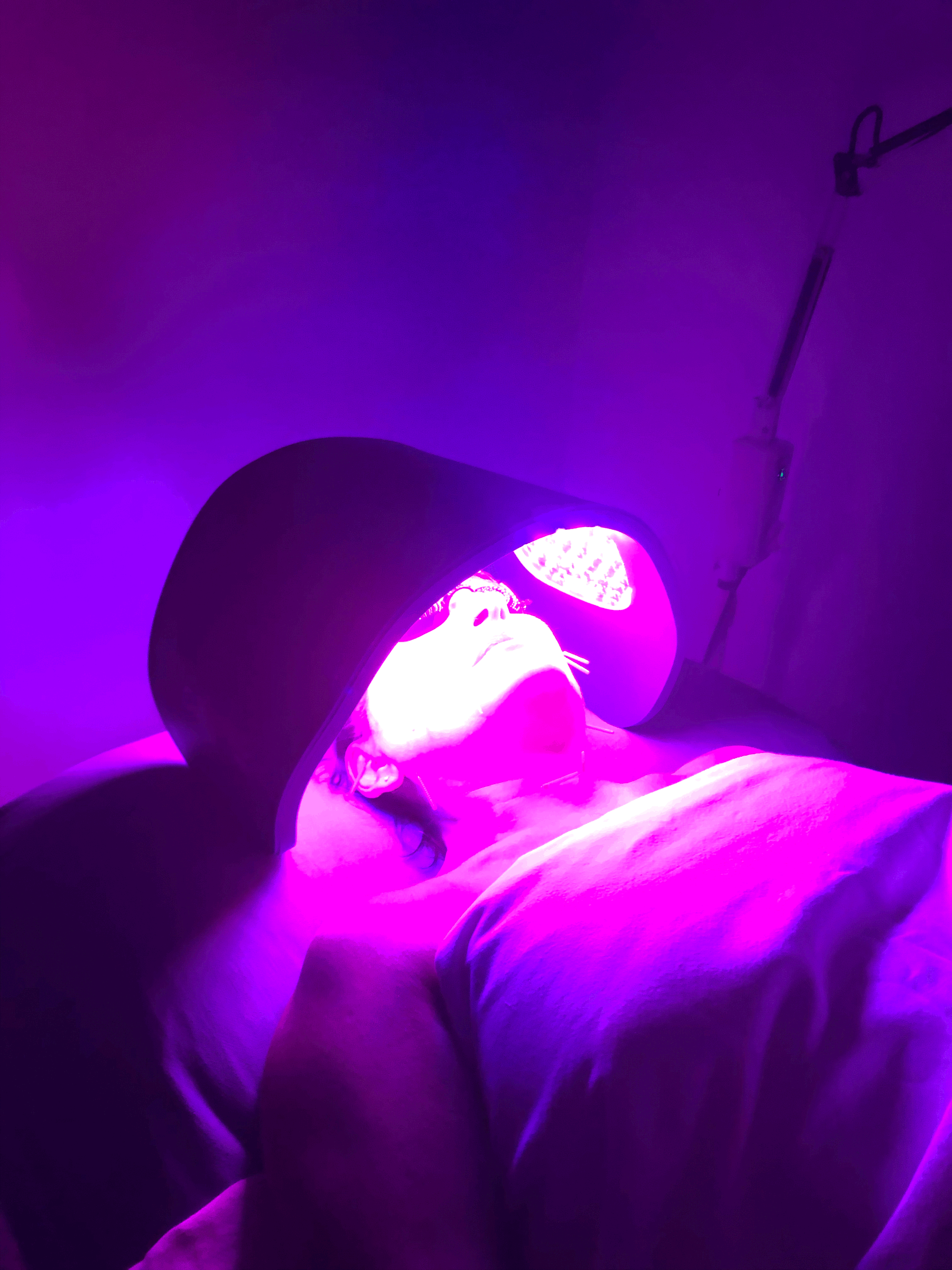 Radiance Renewal Package