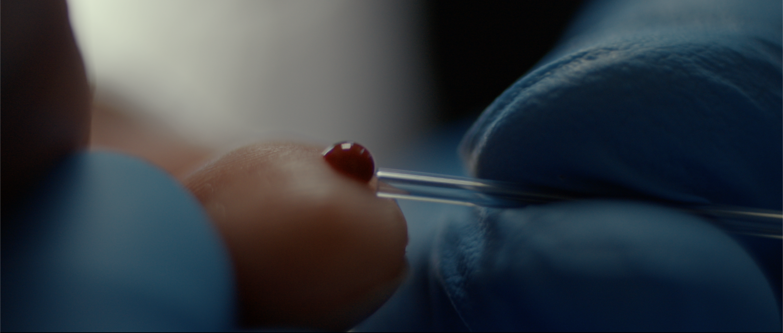 Lactate sampling.png
