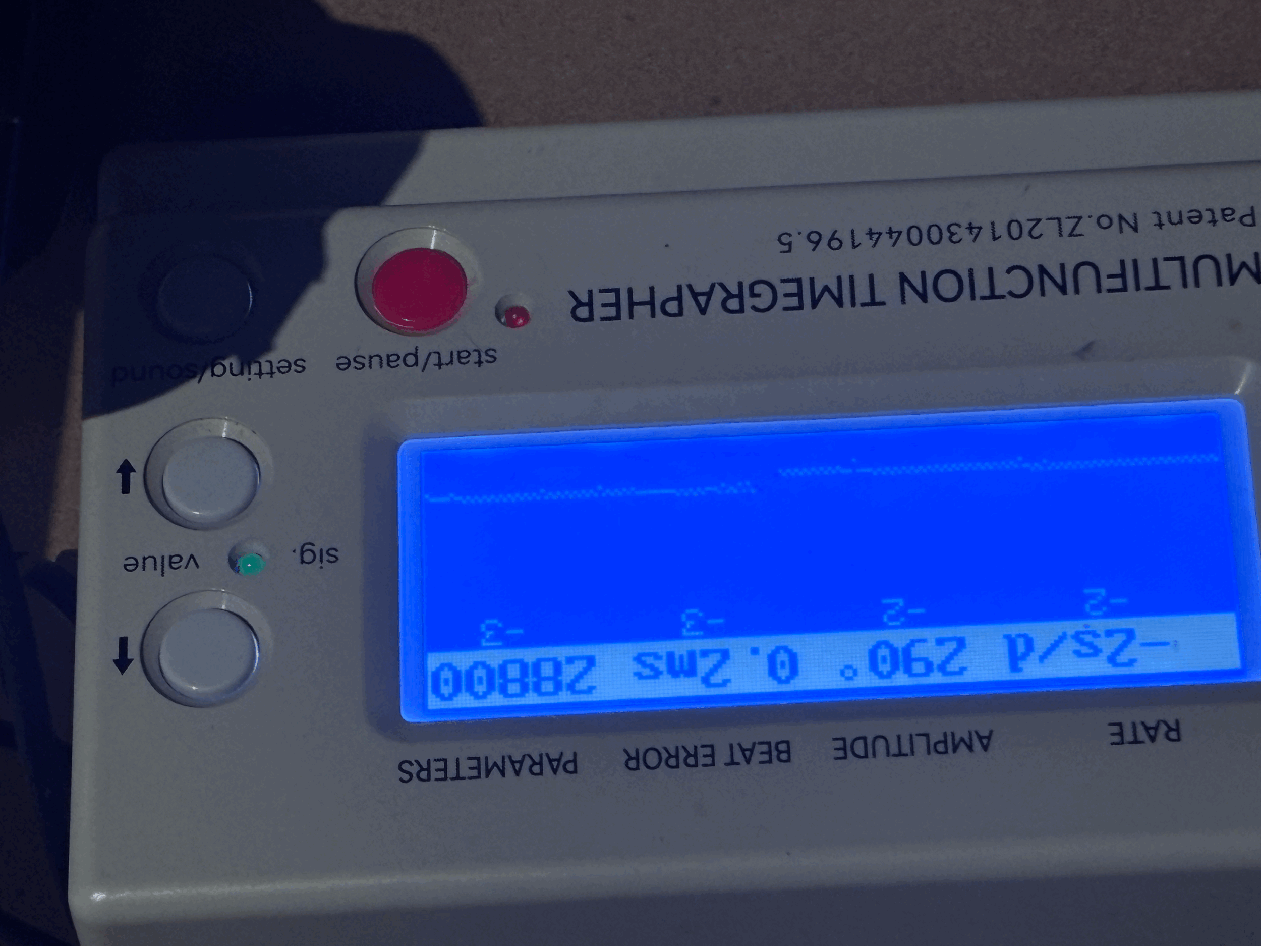 IMG_5882KLZ50G.gif