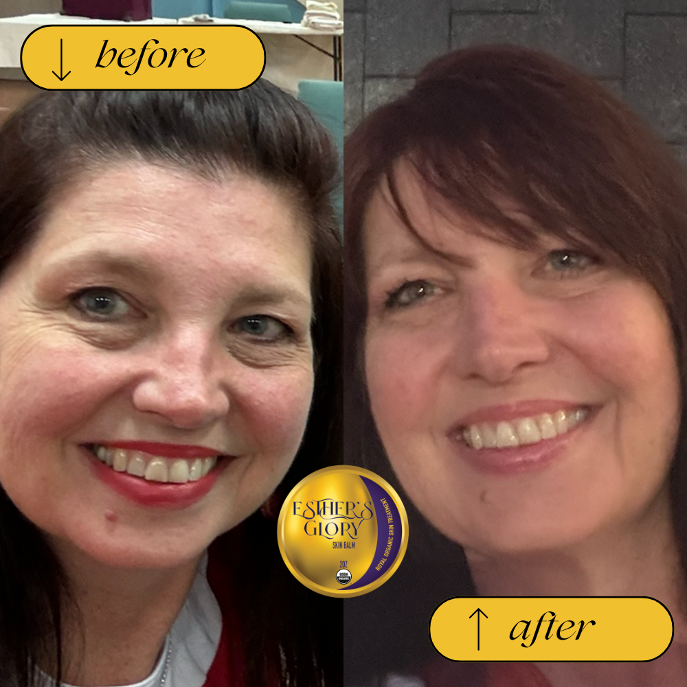 lois before after.png