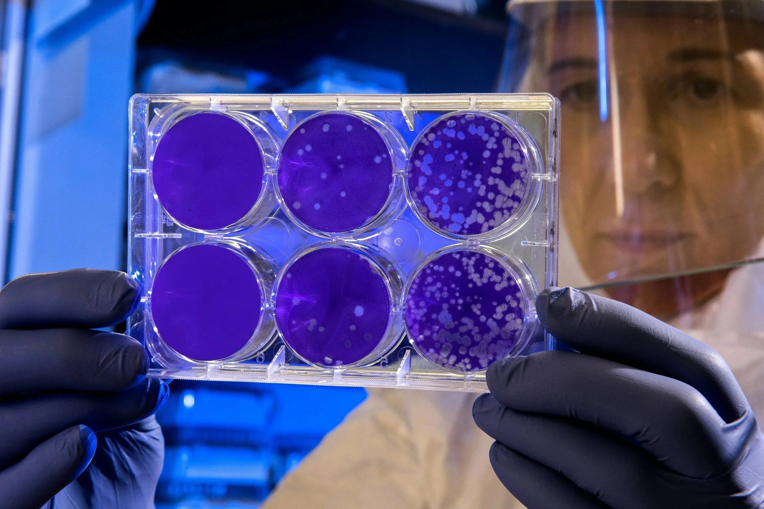 Understanding the role of the gut microbiome