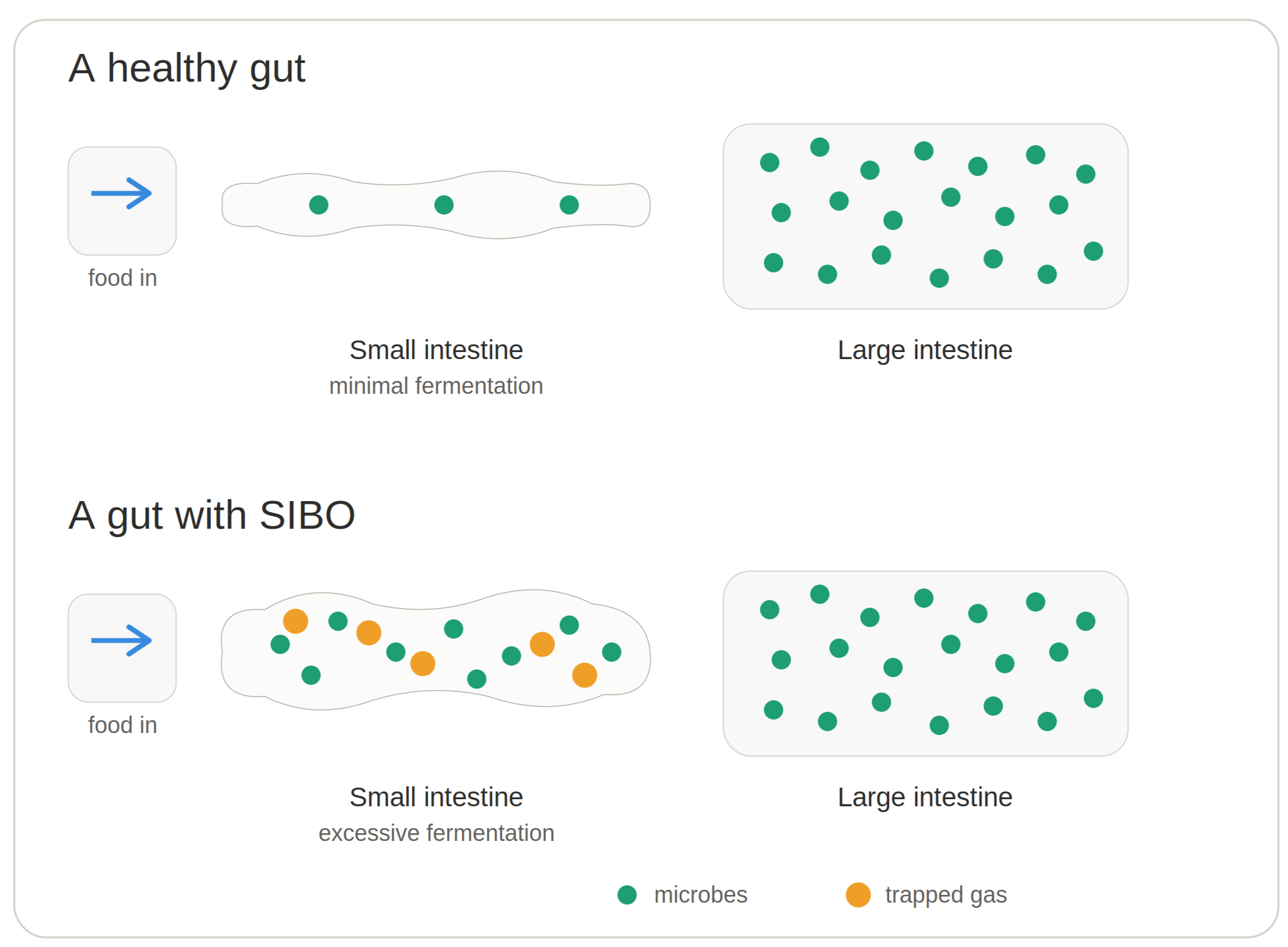 Gut fermentation in a healthy gut versus a gut with SIBO