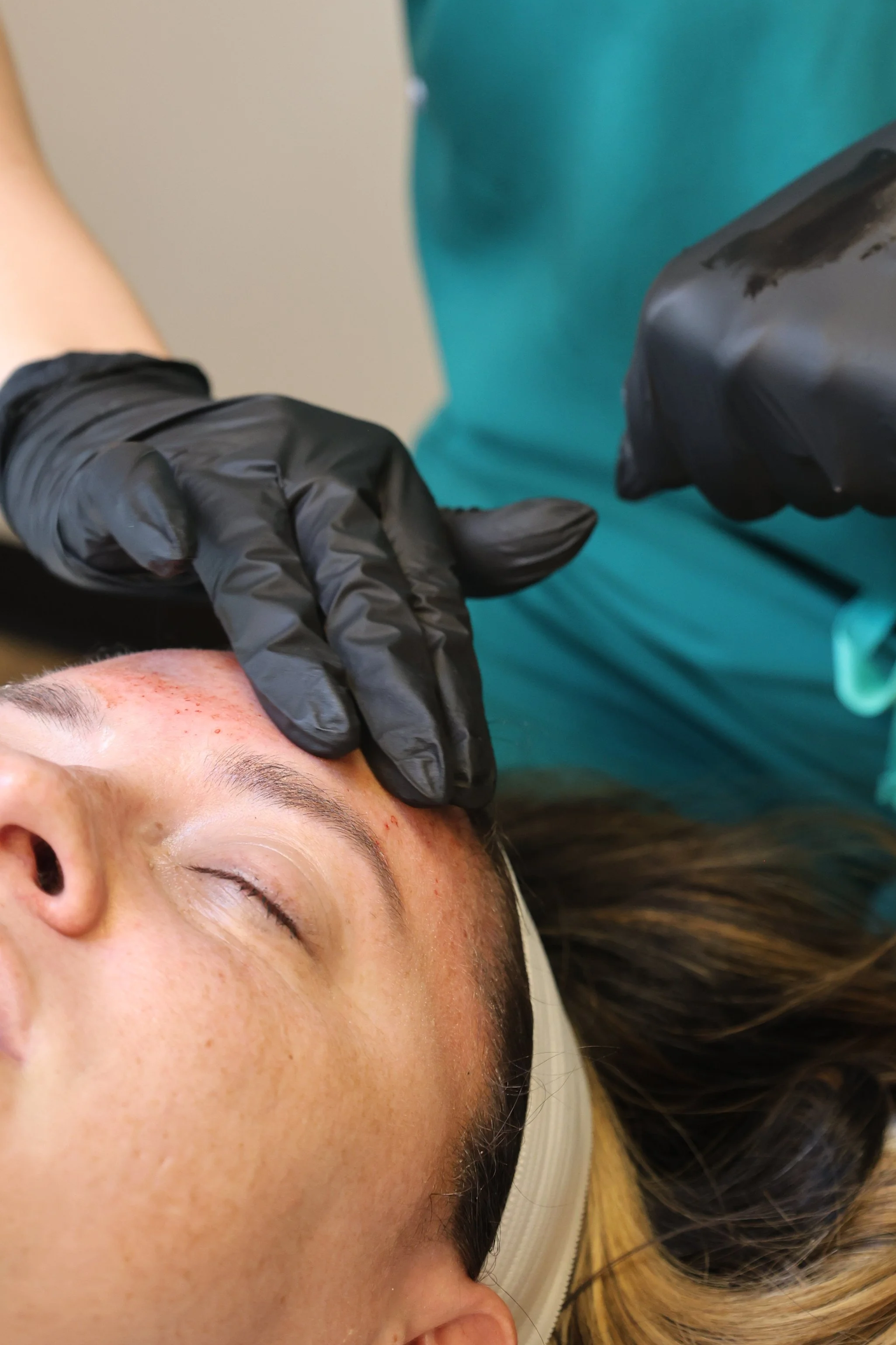 PRP and PRF therapy supporting natural skin rejuvenation and regenerative wellness.
