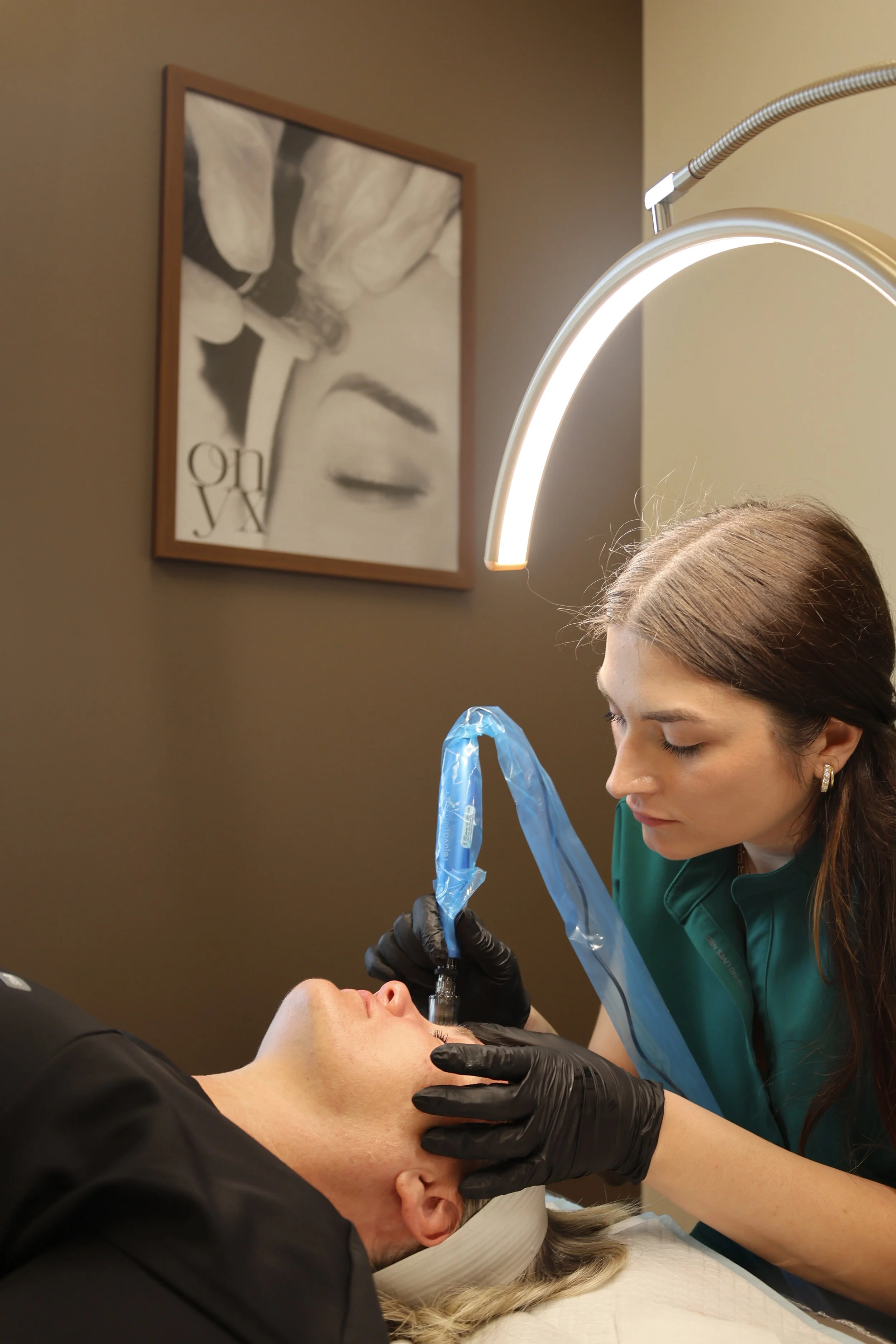Microneedling treatment stimulating collagen for smoother, healthier-looking skin.