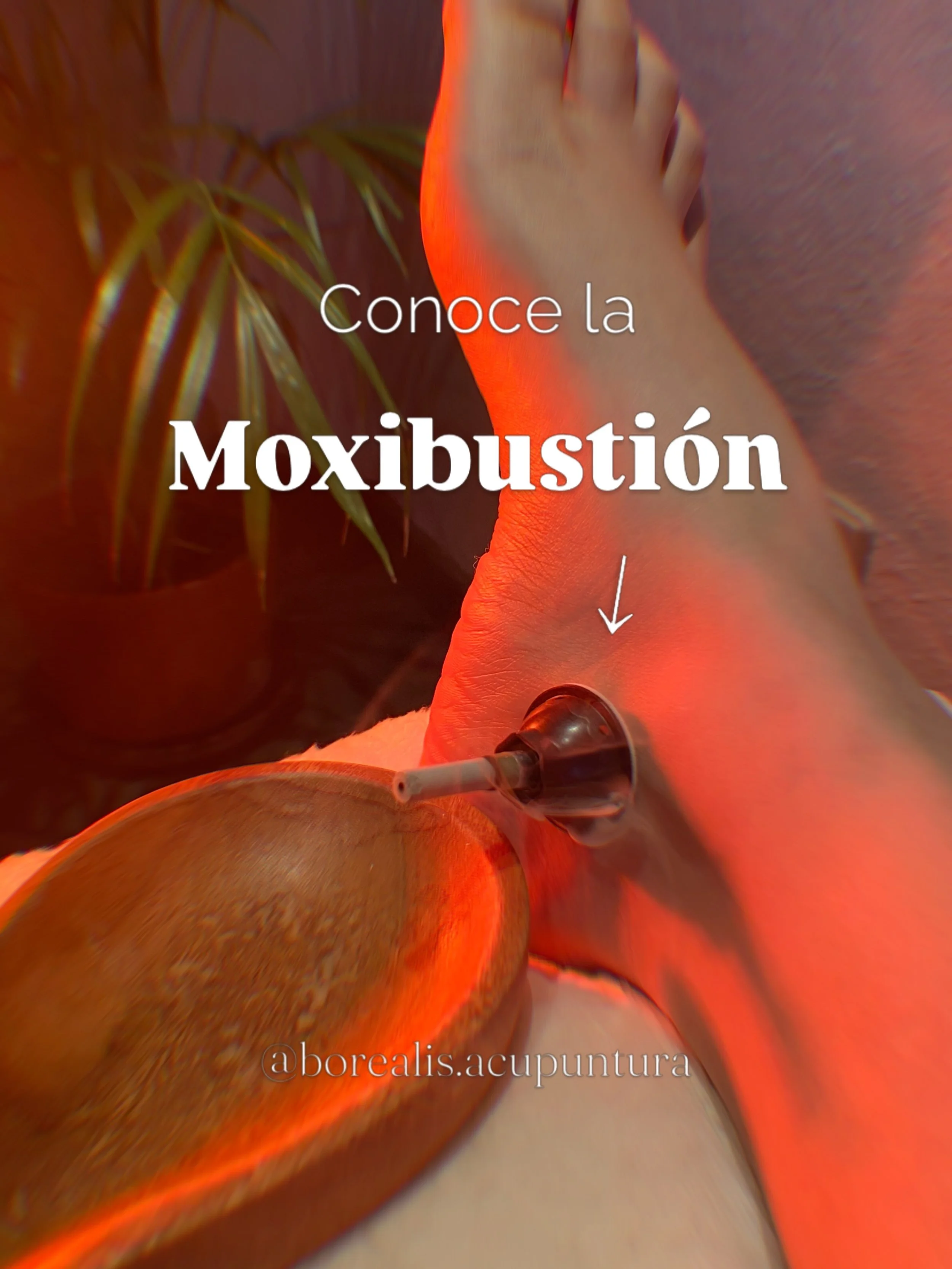 Conoce la moxibusti&oacute;n 🌿🔥

Una t&eacute;cnica de la Medicina Tradicional China que utiliza el calor de la artemisa para estimular puntos y zonas espec&iacute;ficas del cuerpo.

Tradicionalmente, se emplea para favorecer la circulaci&oacute;n 