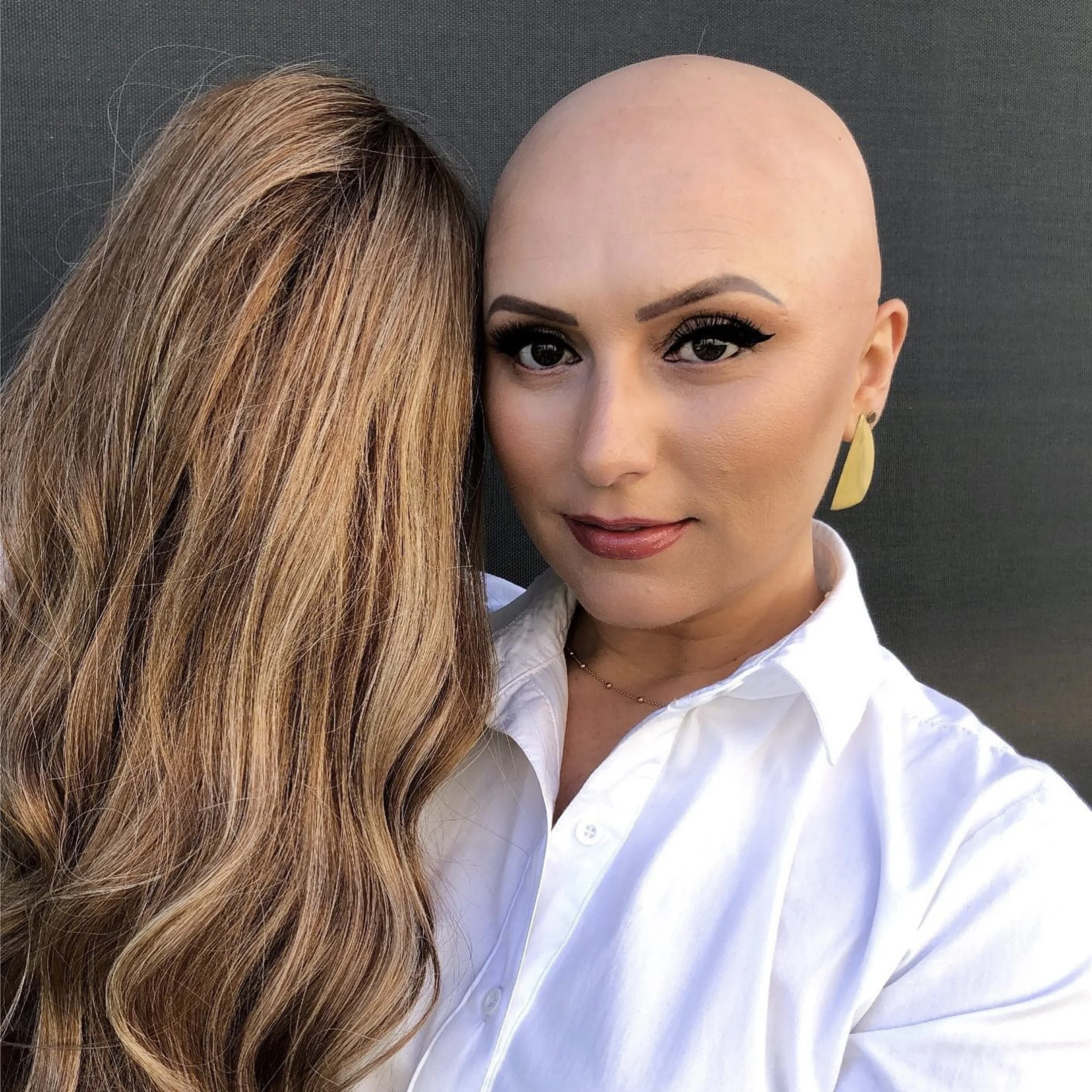 Investing in Your Hair in the midsouth: Why Professional Hair Loss Solutions Matter