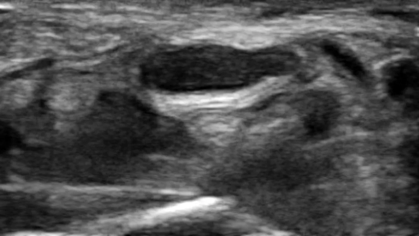 Abstract image representing selective image-guided treatment planning.