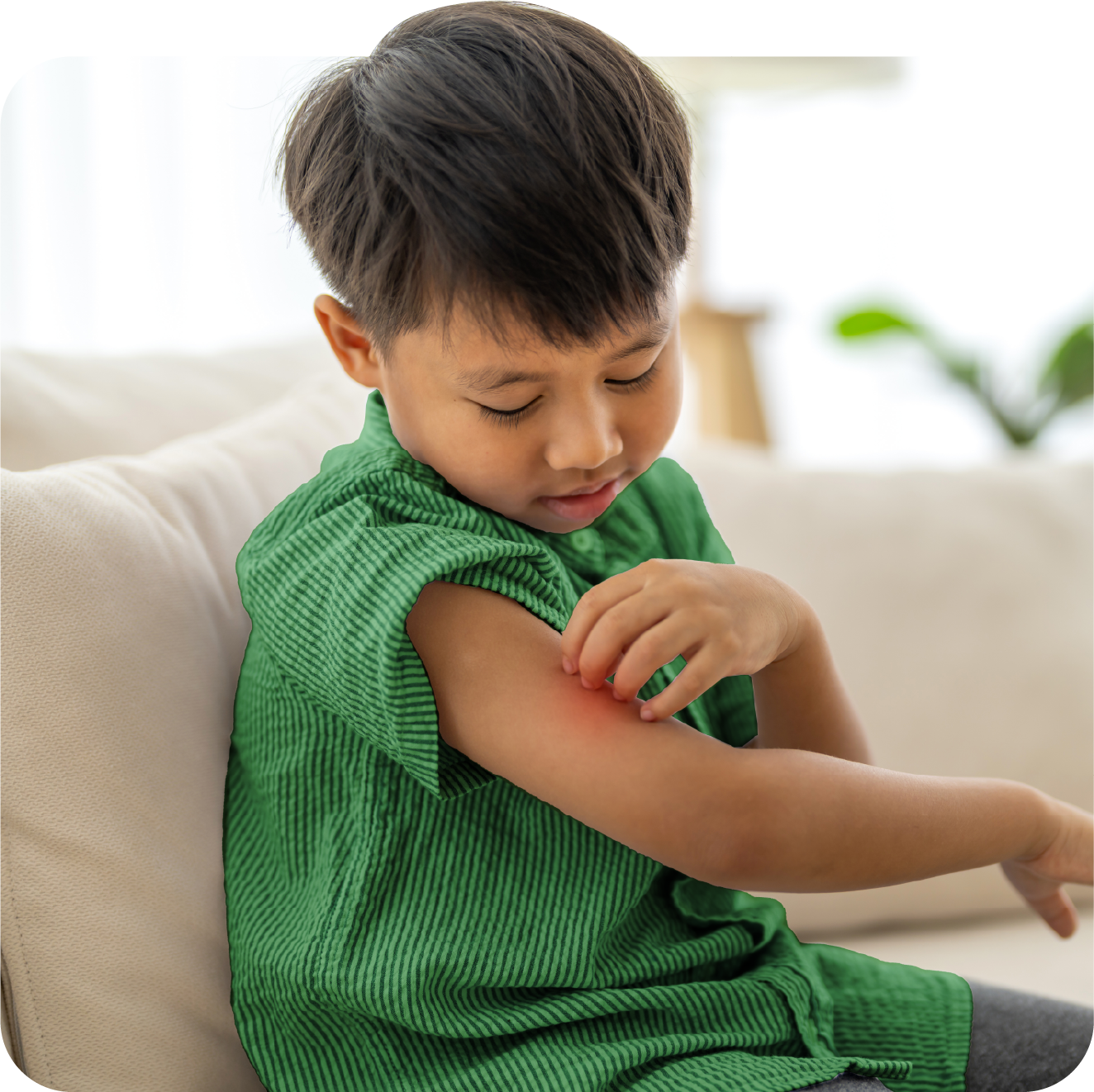 A young boy wearing a green striped shirt sits on a beige couch, looking down and checking his arm where there is a red scratch or rash.