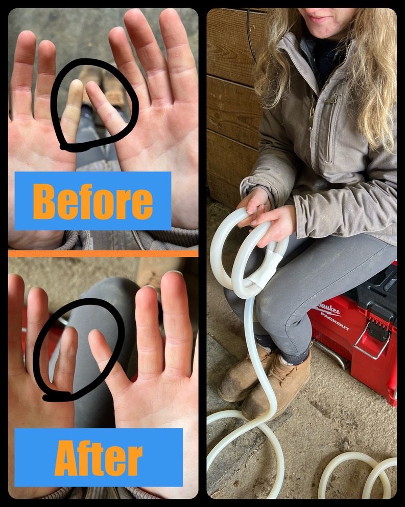 PEMF on sore, white-looking pinkies