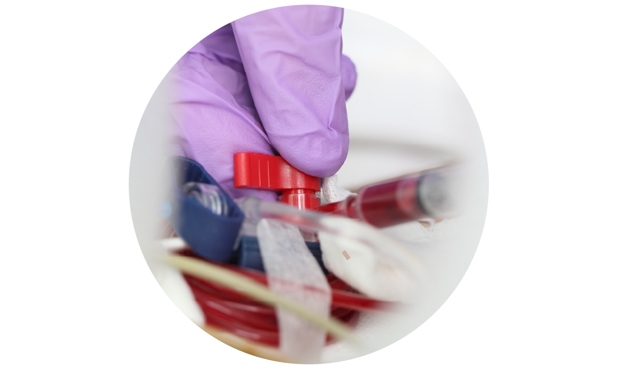 Extreme close-up of a clinician's hand in a medical glove applying an arterial line to a patient.