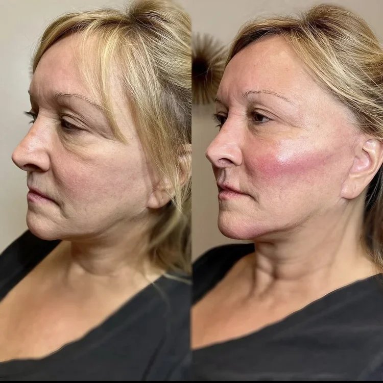 Facial Balancing