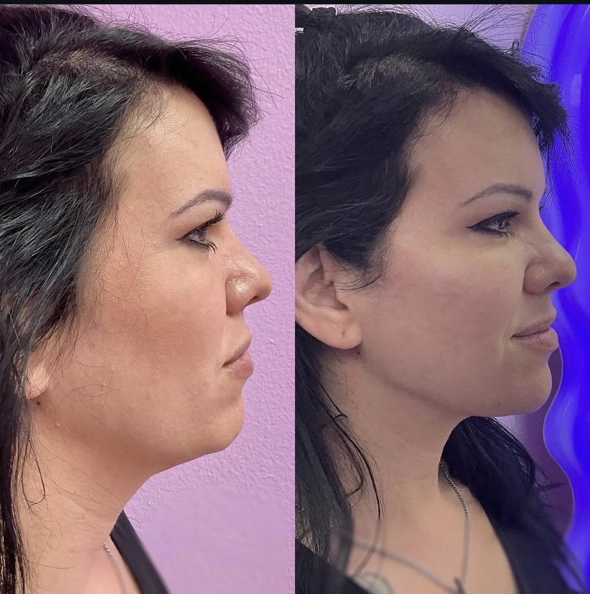 Facial Balancing