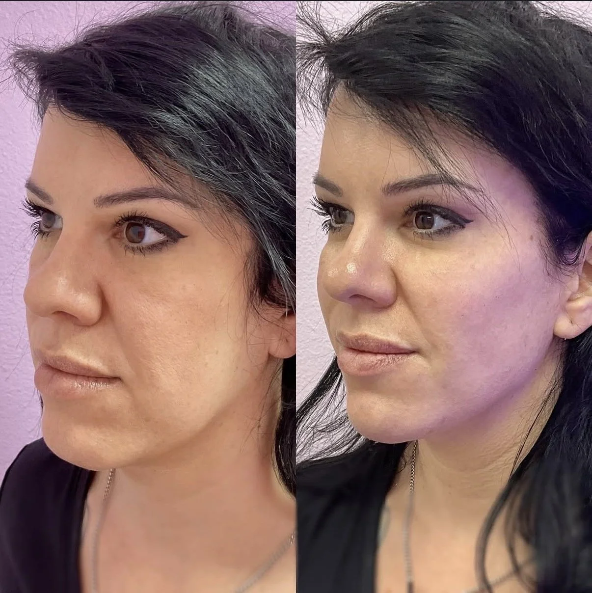 Facial Balancing