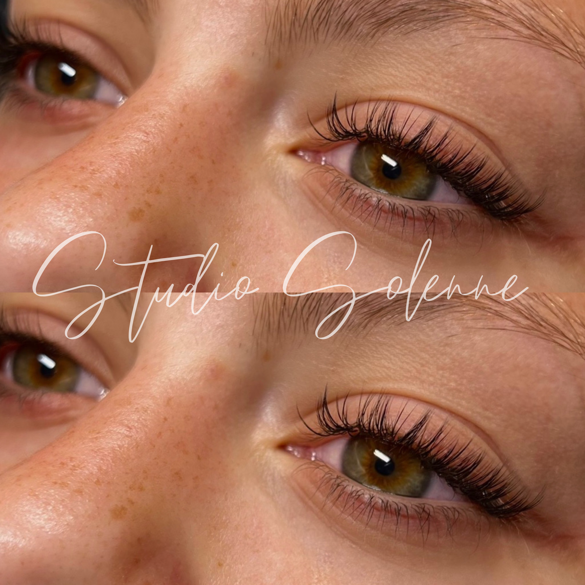 A close-up image of a person's eyes and nose, showing brown eyes with long eyelashes and freckles on the skin. The photo is duplicated with a watermark that says "Studio Zolonne" across the middle.