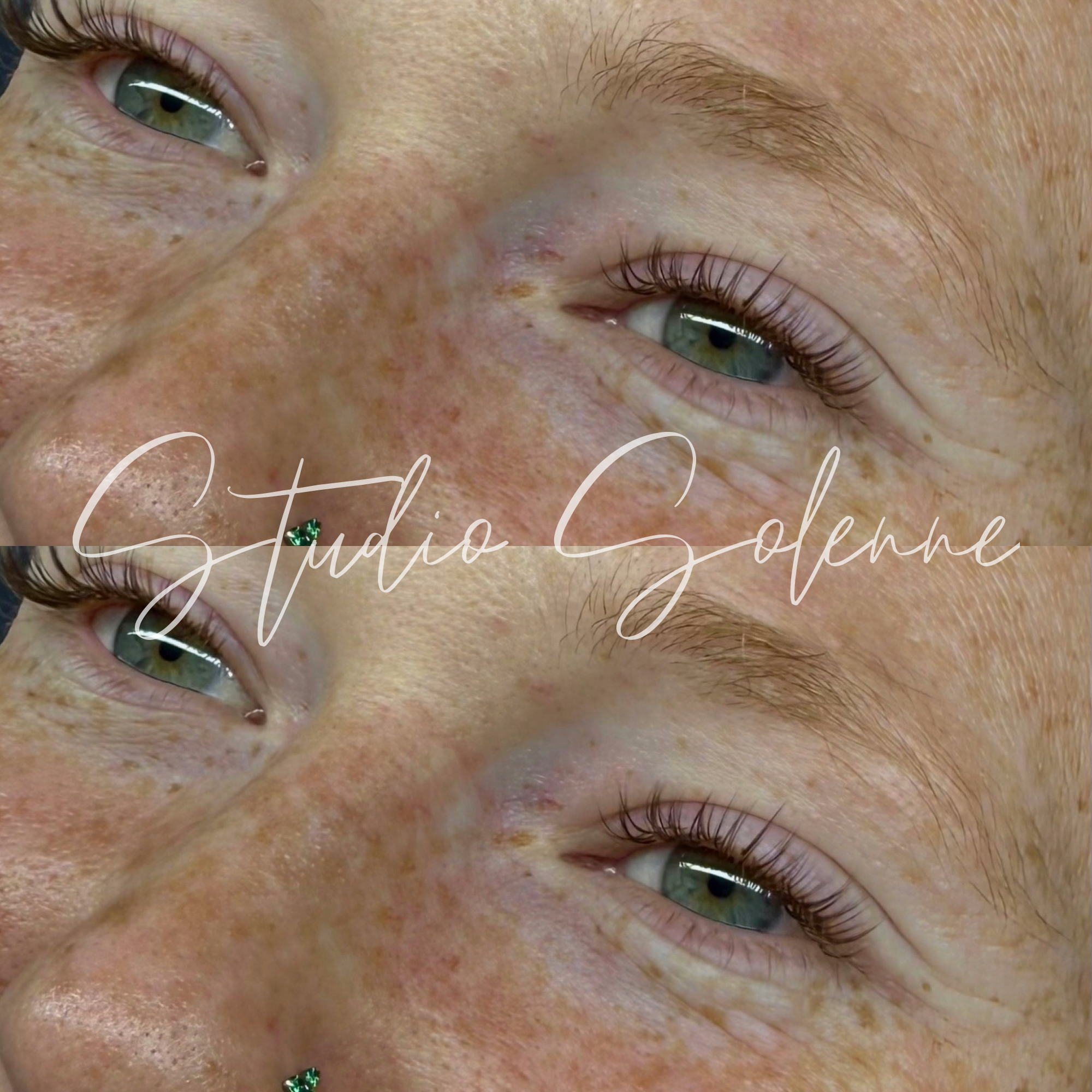 Close-up of a person's face showing eyes, freckles, and skin texture with overlaid text 'Studio Solenne'.