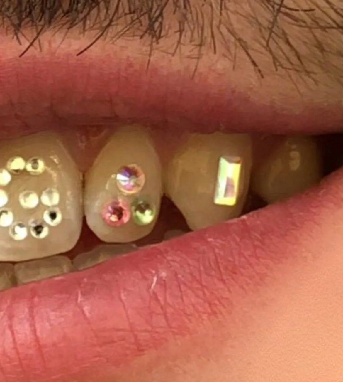 💎 Single Tooth Gem 💎