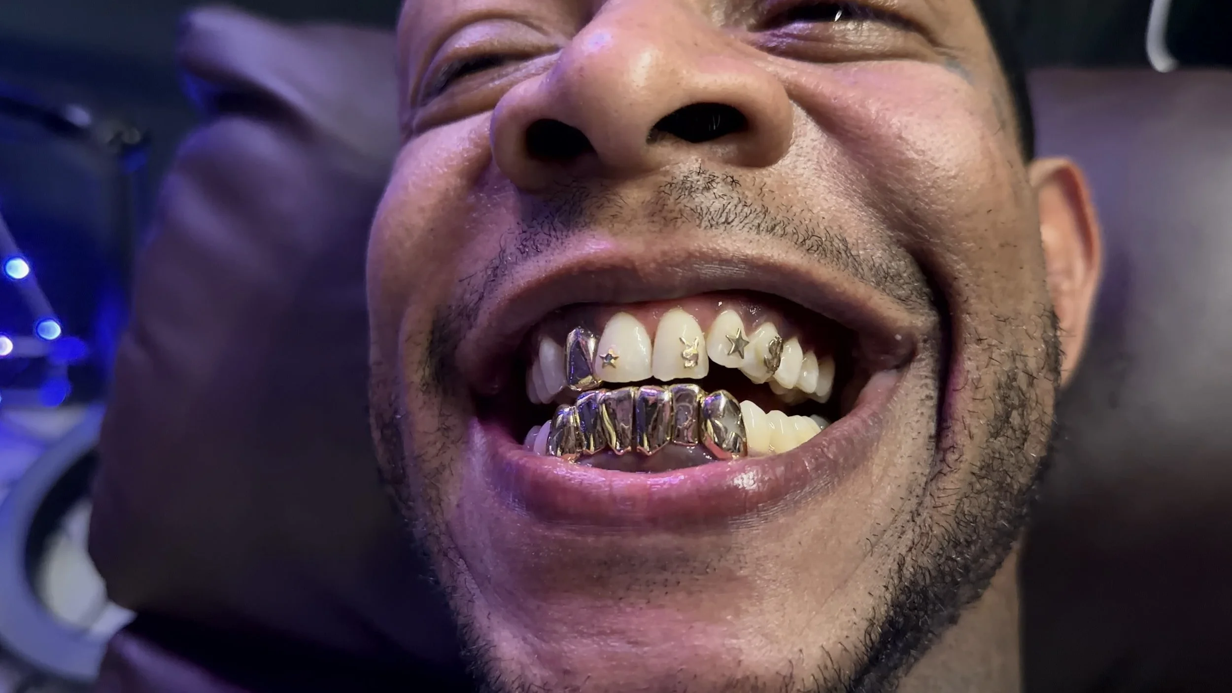 Permanent Gold Grillz