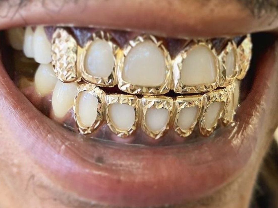 Gold Grillz